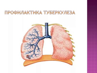 Профилактика туберкулеза